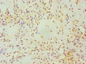 Polyclonal Rabbit anti-Human HBP17 / FGFBP1 Antibody (aa22-232, IHC)