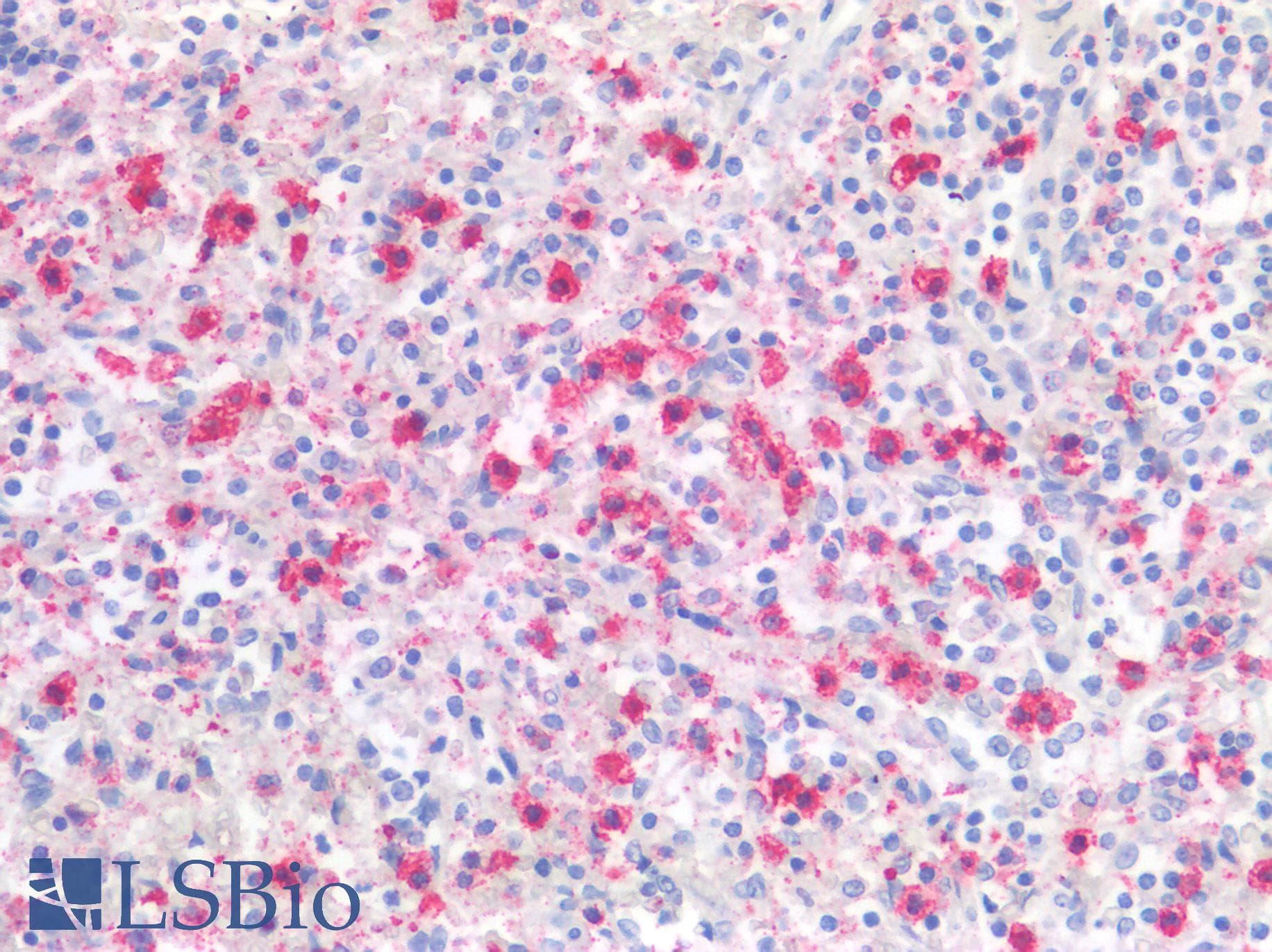 PathPlus™ Monoclonal Mouse anti-Human LAG3 Antibody (clone 9F9, IHC, IF)