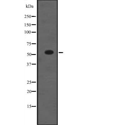 Polyclonal Rabbit anti-Human NR5A1 / SF1 Antibody (WB)