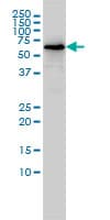 Monoclonal Mouse anti-Human TOE1 Antibody (clone 1D8, IHC, WB)