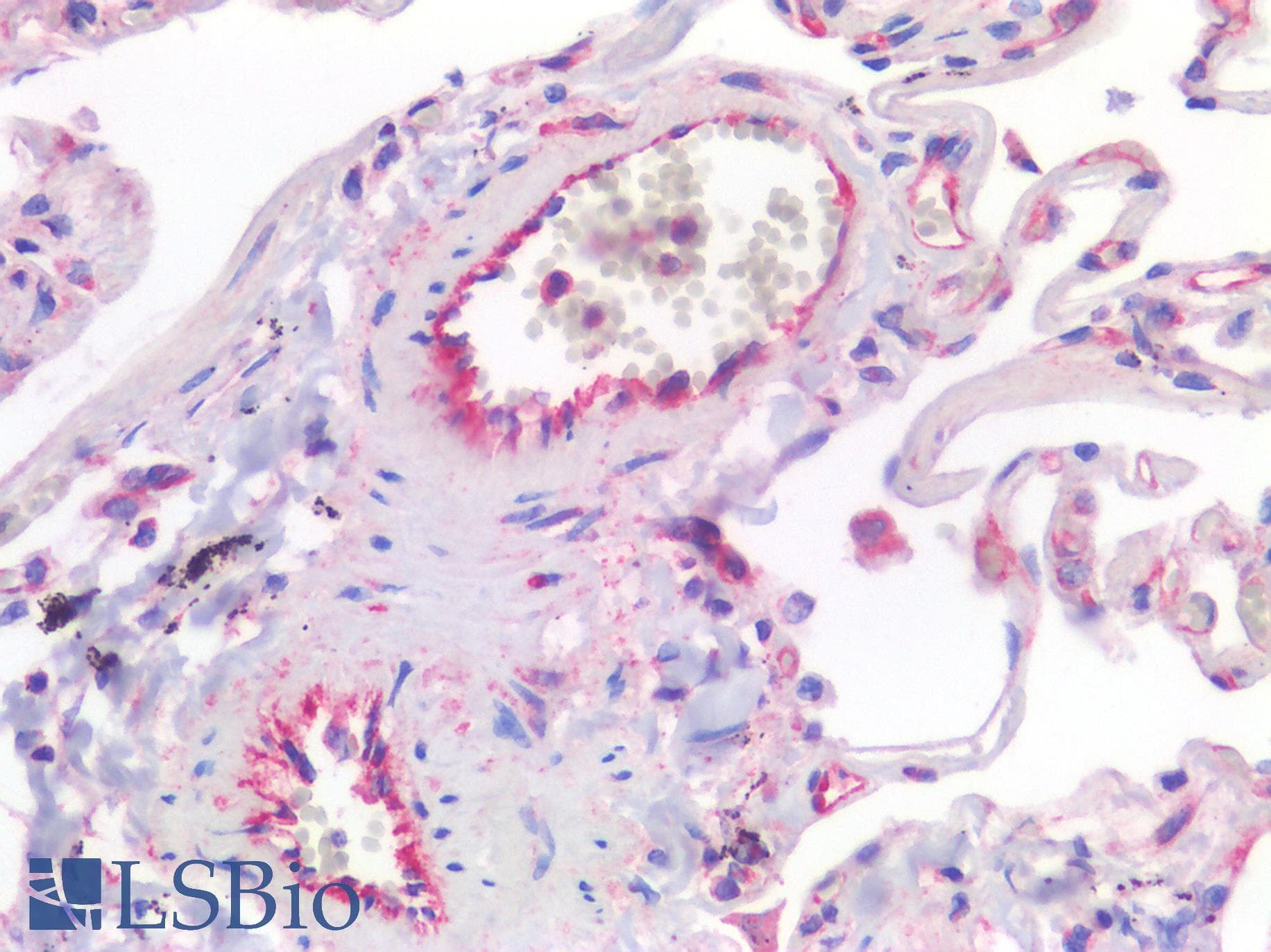 IHC-plus™ VWF / Von Willebrand Factor Antibody