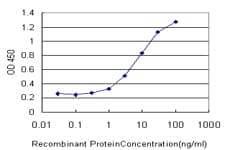 Rhodopsin Kinase / GRK1 Antibody (clone 1G8)
