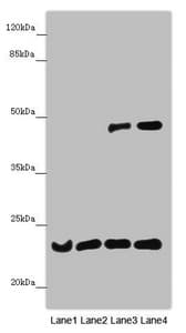 B9D1 Antibody