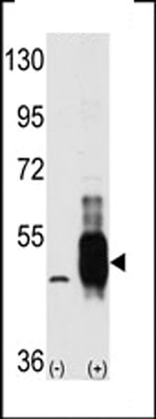 MAP3K8 / TPL2 Antibody (aa414-445)