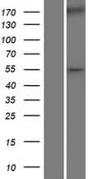 Human WT1 / Wilms Tumor 1 Protein (Over-Expression Lysate Myc-DDK (Flag))
