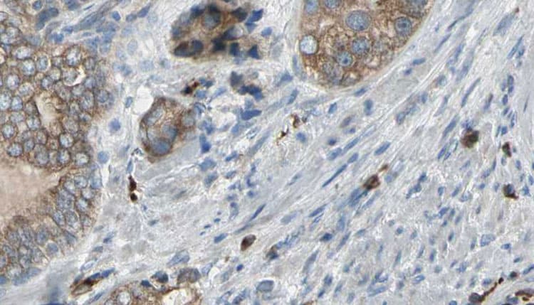 TNNC1 / Cardiac Troponin C Antibody