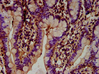 Polyclonal Rabbit anti-Human HECTD2 Antibody (IHC, IF)
