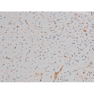 GATA1 Antibody (phospho-Ser142)