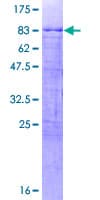 Human CBX6 Protein (Recombinant GST)
