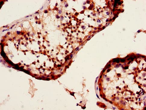Polyclonal Rabbit anti-Human DYX1C1 Antibody (IHC, IF, WB)