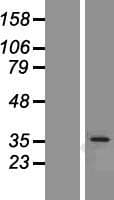 OTUD6B Protein (Over-Expression Lysate Myc-DDK (Flag))