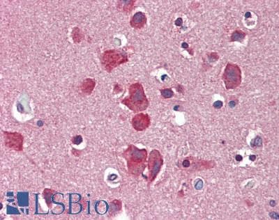 IHC-plus™ SLC8A3 / NCX3 Antibody