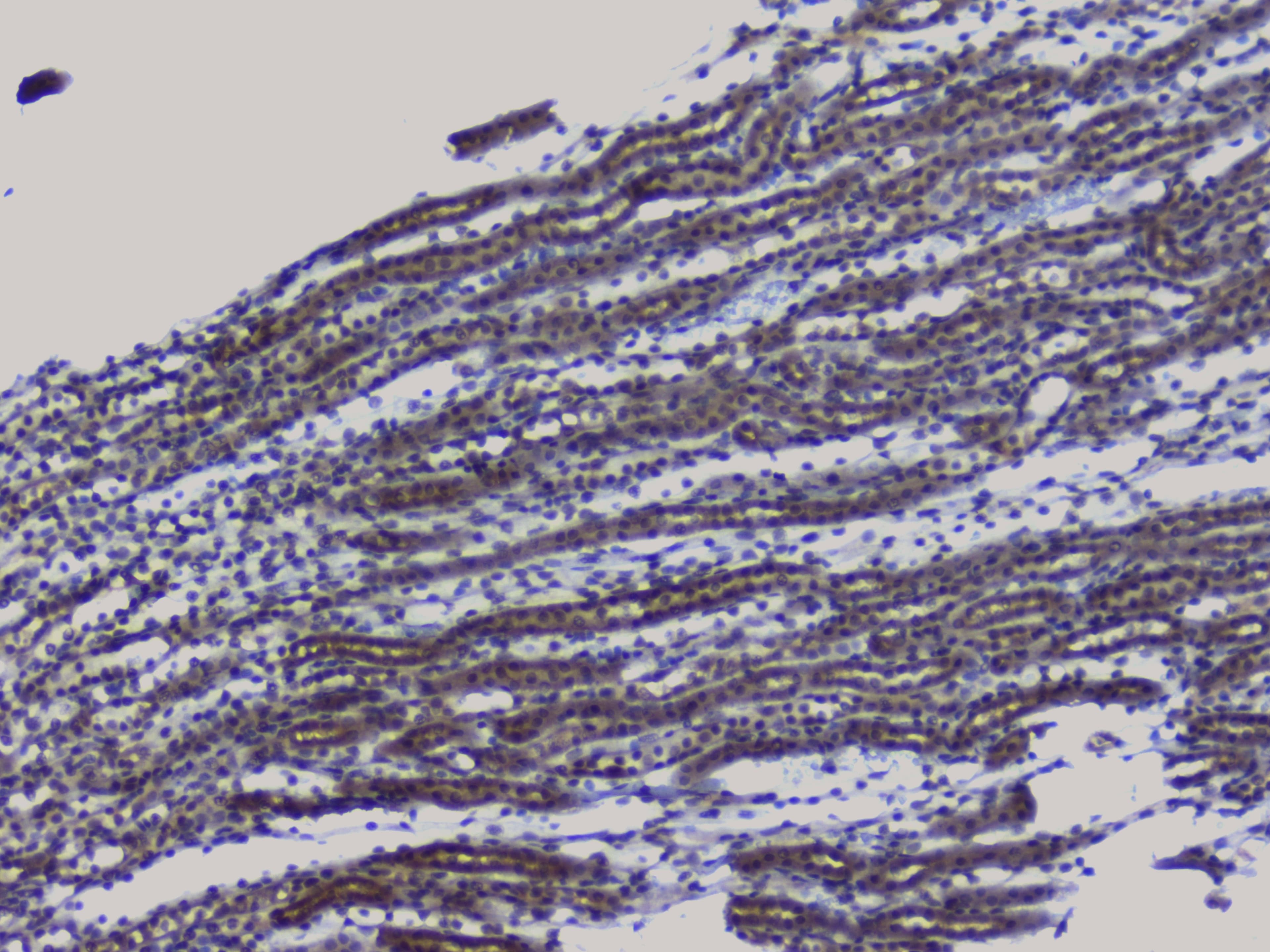 NRF1 / NRF-1 Antibody