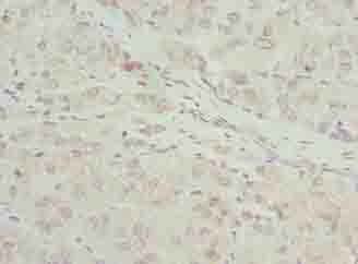 Polyclonal Rabbit anti-Human RIBC2 Antibody (IHC, WB)