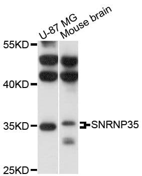 SNRNP35 Antibody