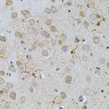 Polyclonal Rabbit anti-Human TSC501 / NAT8 Antibody (IHC, WB)