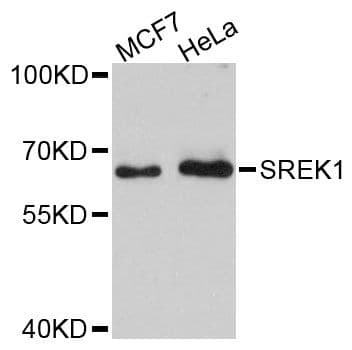 SREK1 / SRRP86 Antibody