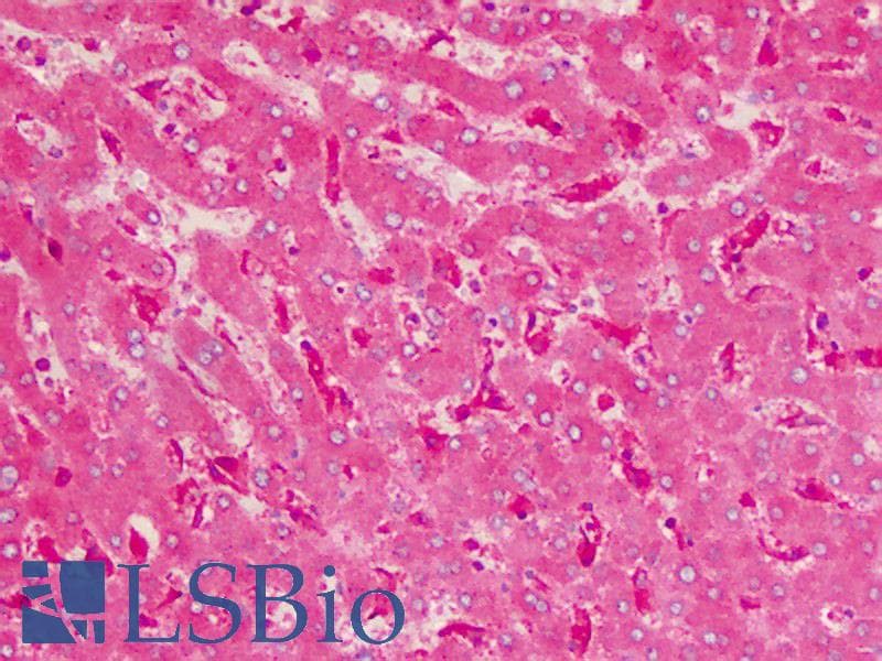 IHC-plus™ GARS / Glycyl tRNA Synthetase Antibody (aa706-739)