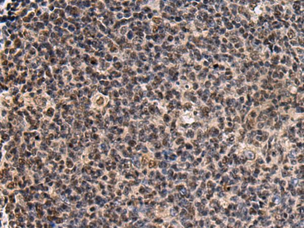 SIK3 / QSK Antibody