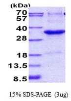 Human JAZF1 Protein (Recombinant His)