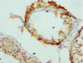 AP2A2 Antibody