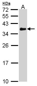 VDAC1 / PORIN Antibody (aa1-211)