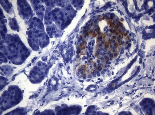 ESRRA / ERR Alpha Antibody (aa1-205, clone OTI3E3)