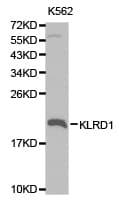 KLRD1 / CD94 Antibody