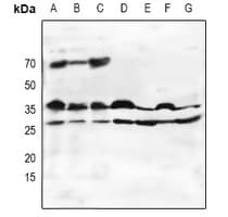 Polyclonal Rabbit anti-Human OLIG2 Antibody (WB)