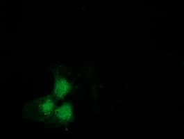 SNTA1 / Syntrophin Alpha 1 Antibody (clone OTI2B4)