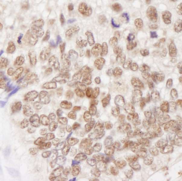 MSH2 Antibody (aa875-C-term)
