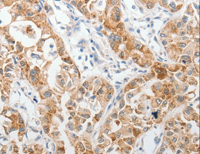 PIBF1 / PIBF Antibody