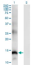 SLPI / Antileukoproteinase Antibody (clone 3C6)