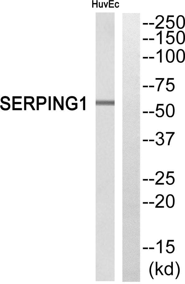 Polyclonal Rabbit anti-Human SERPING1 / C1 Inhibitor Antibody (IHC, WB)