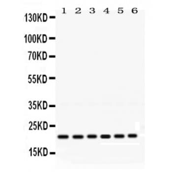 RAB10 Antibody (aa153-185)