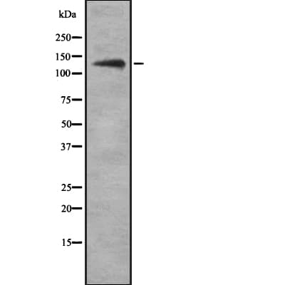 UBN1 / Ubinuclein 1 Antibody