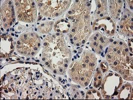 ACOT12 Antibody (clone OTI1B9)