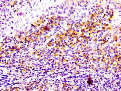 Recombinant Monoclonal Rabbit anti-Human CD81 Antibody (IHC, WB)