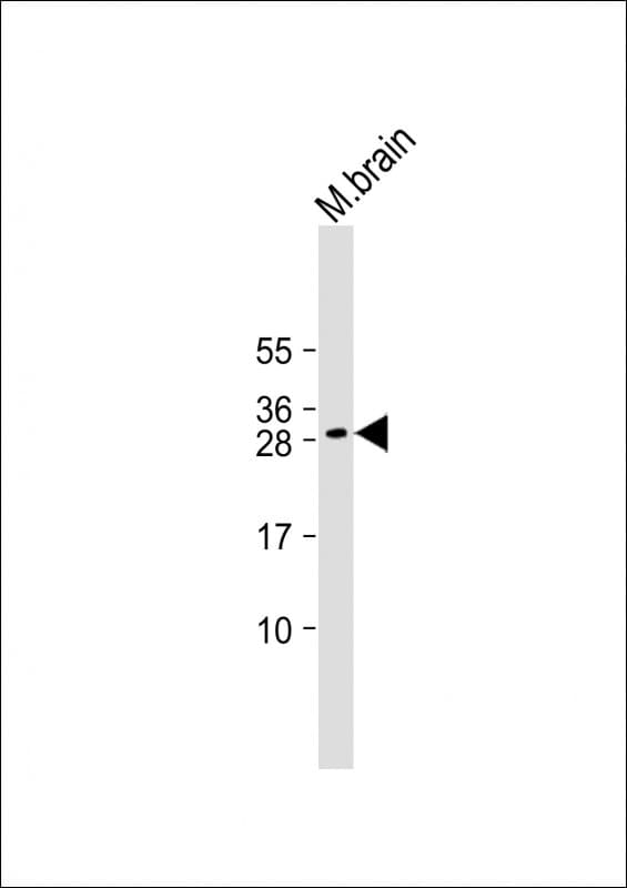 DLX1 Antibody (Internal)