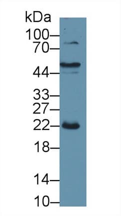 CRP / C-Reactive Protein Antibody (aa20-222, APC)