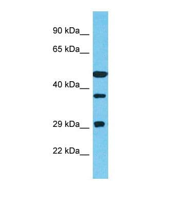 TTC23 Antibody (C-Terminus)