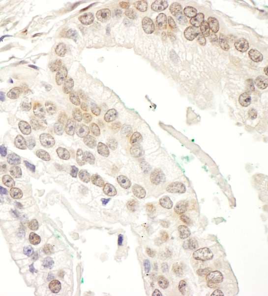 Polyclonal Rabbit anti-Human RBM34 Antibody (aa370-430, IHC, WB)