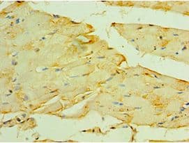 Polyclonal Rabbit anti-Human MYOT / Myotilin Antibody (aa443-498, IHC, WB)
