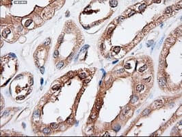 PTCH1 / Patched 1 Antibody (clone OTI5C7)