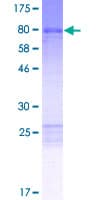 Human ANKS6 Protein (Recombinant GST)