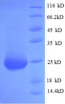 Rat FGF23 Protein (Recombinant His)