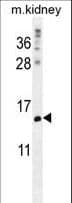Polyclonal Rabbit anti-Human MORN5 Antibody (aa93-122, IHC, WB)