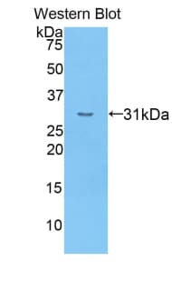 CR1 / CD35 Antibody (aa1780-2039, PE)