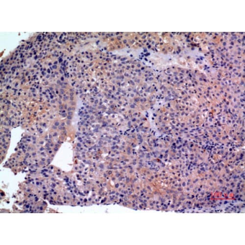 Polyclonal Rabbit anti-Human SERPINB3 Antibody (101-150 aa, Internal, IHC, WB)
