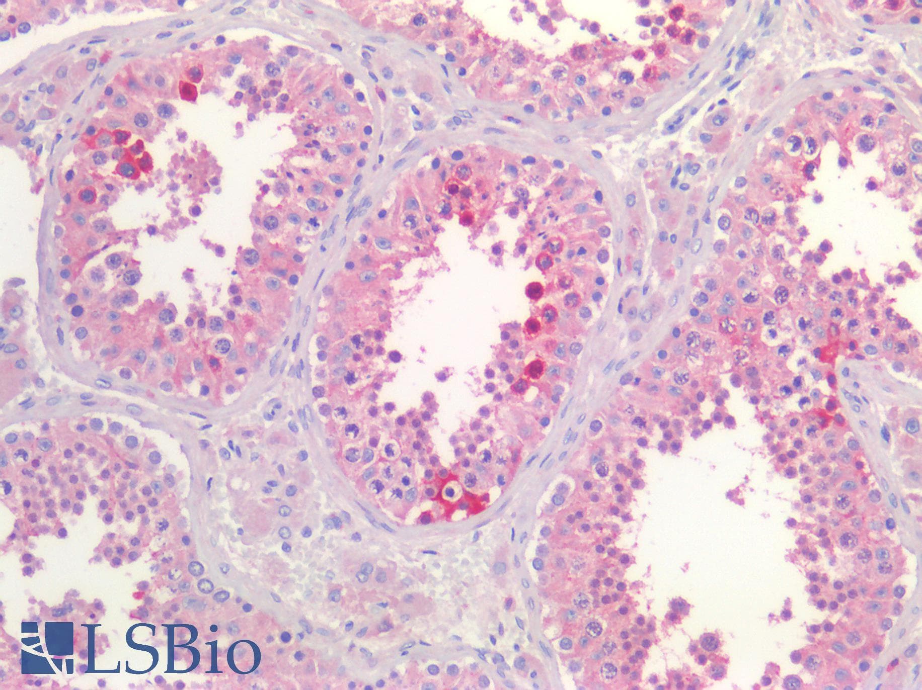 IHC-plus™ CLU / Clusterin Antibody (aa488-501)
